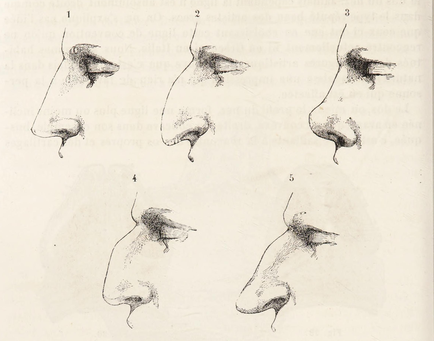 typy kształtów nosa ludzkiego