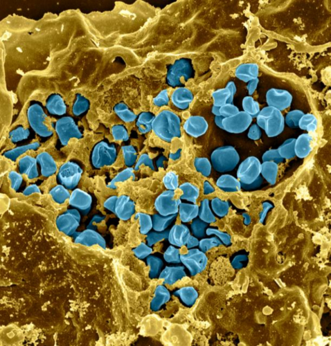 Bakteria -  pałeczka tularemii o wymiarach 0,2-0,5 µm (wybarwiona na niebiesko) w makrofagach